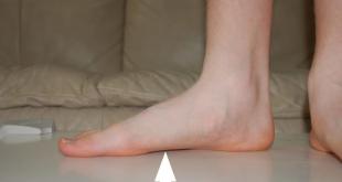 Причины и лечение судорог в икрах ног